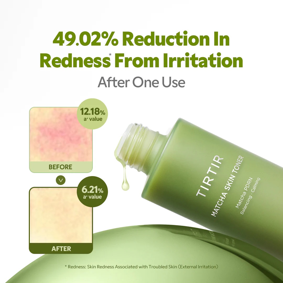 TIRTIR Matcha Skin Toner bottle with before and after images showing 49.02% reduction in redness from irritation after one use.